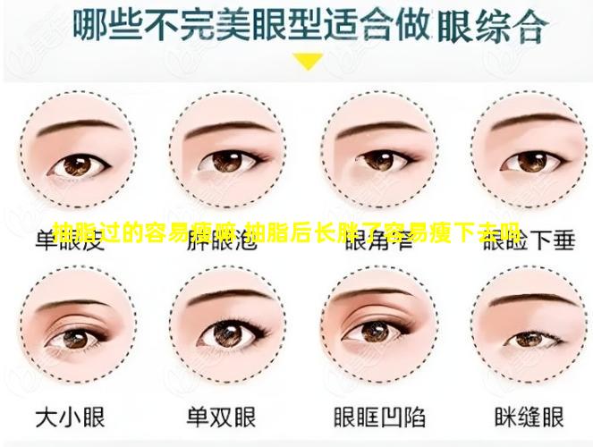 抽脂过的容易瘦嘛 抽脂后长胖了容易瘦下去吗